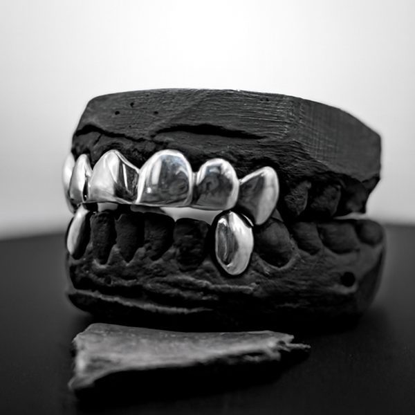 White Gold Permanent Crown